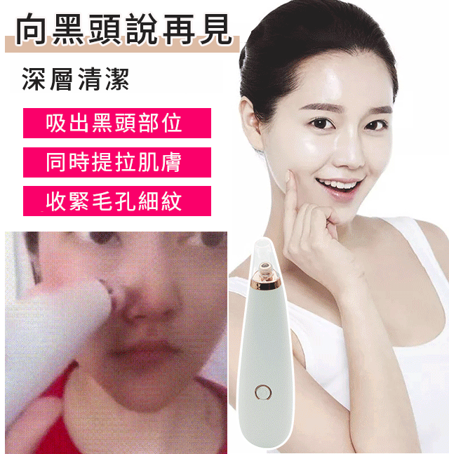 【家用吸黑頭神器】黑頭、粉刺、痘痘都不見了，深層清潔，收縮毛孔細紋！