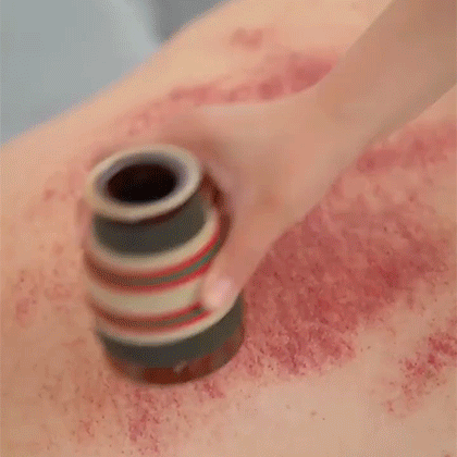 2.gif